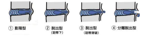 バナー